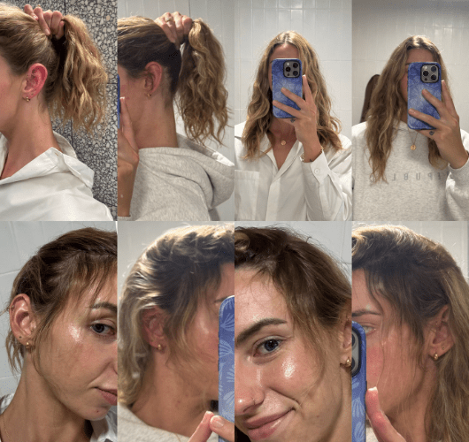Collage of a woman showing different angles and close-ups of her results.