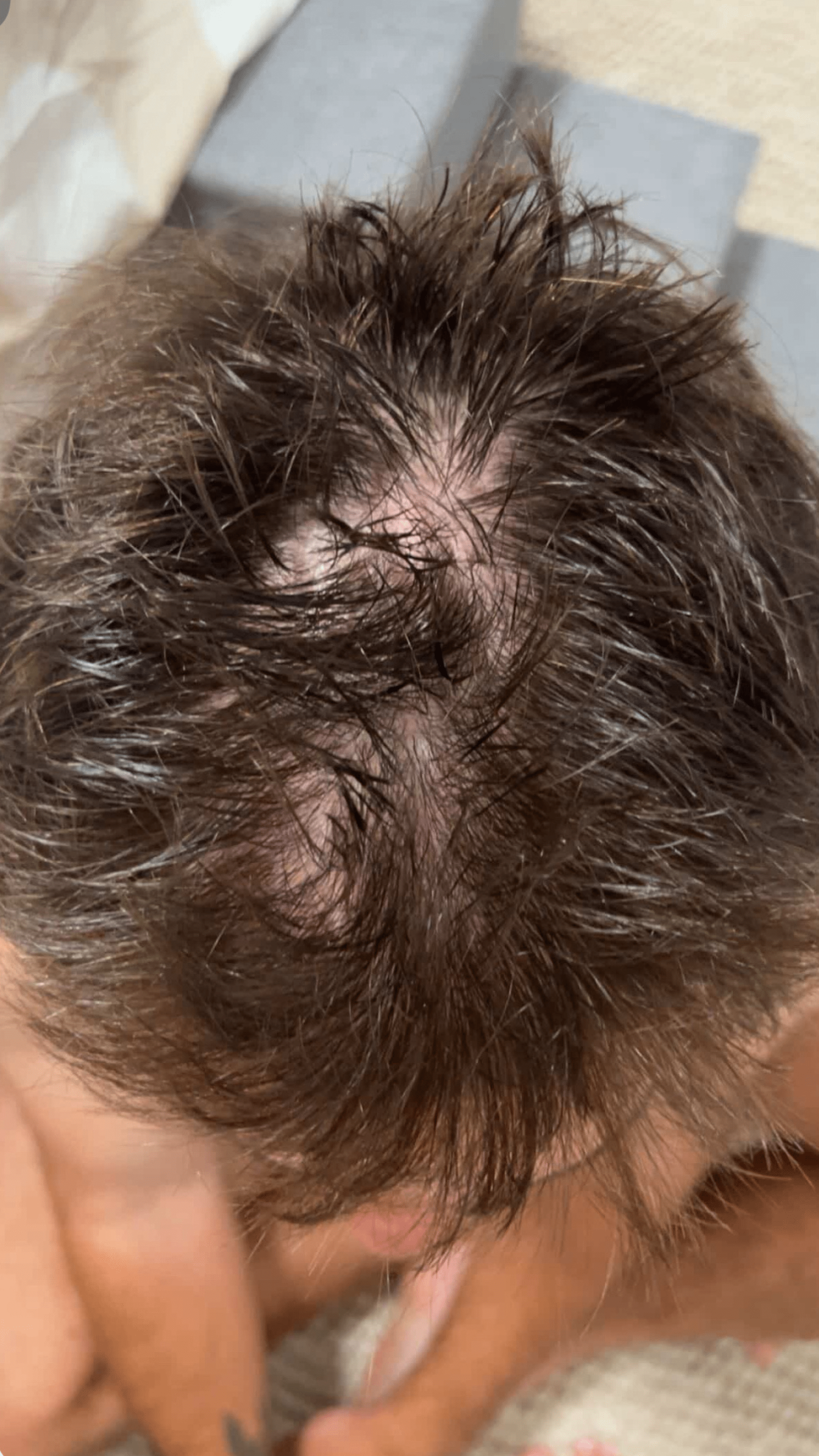 Close-up of a person's scalp before using Bouf products.