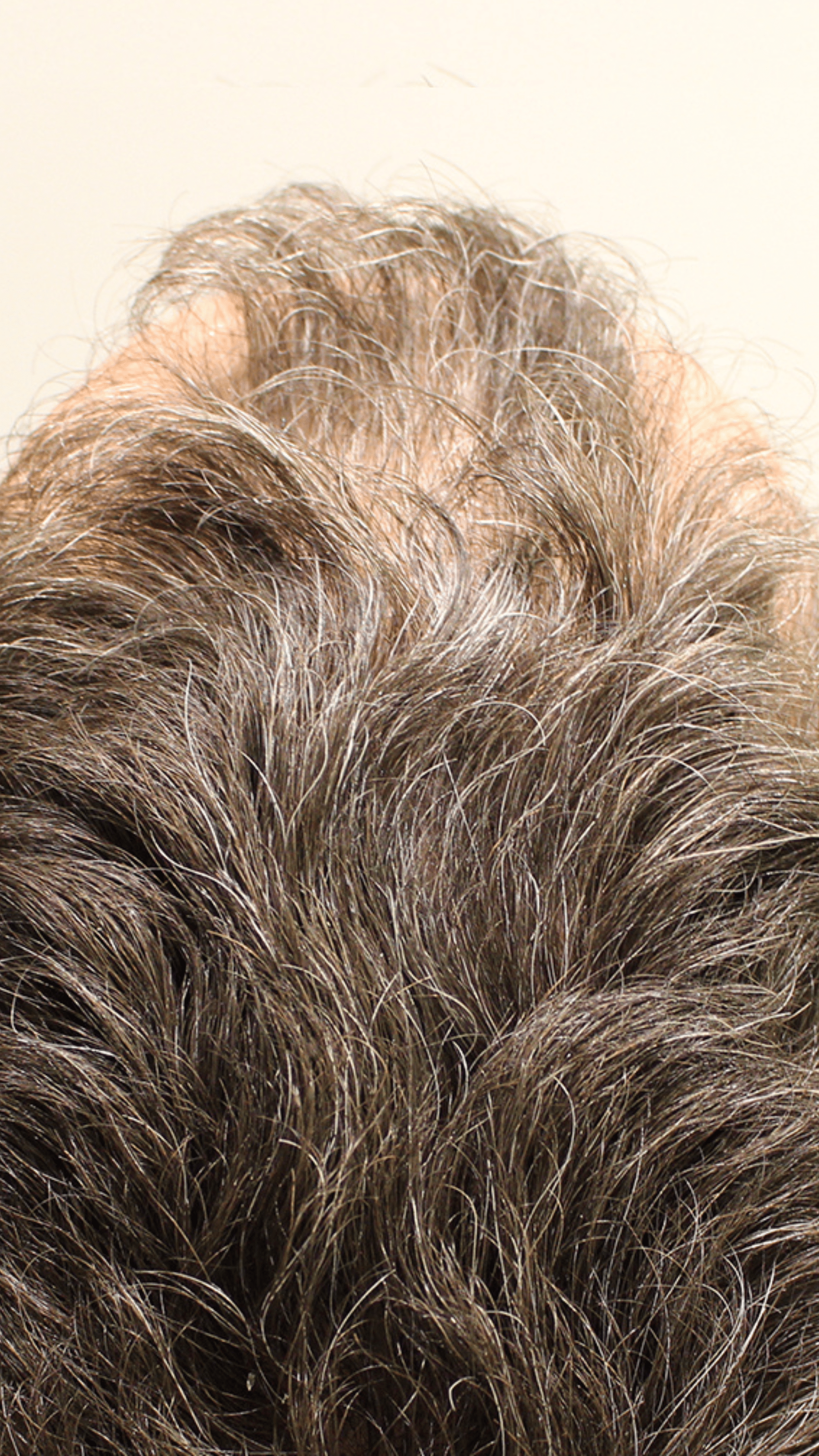 Close-up of a males results of using Bouf.